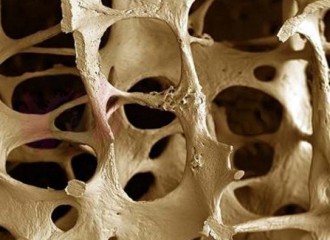 Obrazek: Bezpłatne badania gęstości kości dla osób 50+